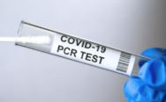 PCR_Test.jpg